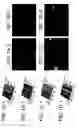 Fig. 02 - Bioartificial device for propagation of tissue, preparation and uses thereof