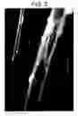 Fig. 03 - Bioartificial device for propagation of tissue, preparation and uses thereof