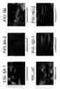 Fig. 07 - Bioartificial device for propagation of tissue, preparation and uses thereof