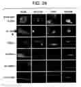 Fig. 26 - Bioartificial device for propagation of tissue, preparation and uses thereof