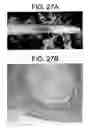 Fig. 29 - Bioartificial device for propagation of tissue, preparation and uses thereof