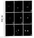 Fig. 32 - Bioartificial device for propagation of tissue, preparation and uses thereof