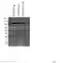 Fig. 04 - Platlet glycoprotein Ib alpha fusion polypeptides and methods of use thereof