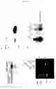 Fig. 02 - Nephropathy-associated gene