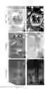 Fig. 08 - Nephropathy-associated gene