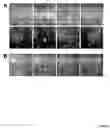 Fig. 03 - Eph/ephrin mediated modulation of cell adhesion and tumour cell metastasis