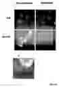 Fig. 09 - Eph/ephrin mediated modulation of cell adhesion and tumour cell metastasis