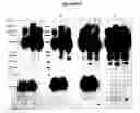 Fig. 06 - Cytotoxicity mediation of cells evidencing surface expression of CD59