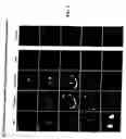 Fig. 03 - Proteic binding partners of TCTP and methods of modulating tumor reversion or cell apoptosis
