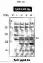 Fig. 06 - Cell surface expression vector of sars virus antigen and microorganisms transformed thereby