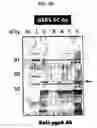Fig. 07 - Cell surface expression vector of sars virus antigen and microorganisms transformed thereby