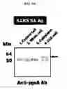 Fig. 09 - Cell surface expression vector of sars virus antigen and microorganisms transformed thereby