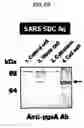Fig. 10 - Cell surface expression vector of sars virus antigen and microorganisms transformed thereby