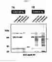 Fig. 12 - Cell surface expression vector of sars virus antigen and microorganisms transformed thereby