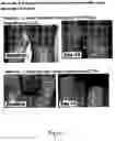 Fig. 02 - Cosmetic and pharmaceutical foam