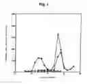 Fig. 02 - Method of detecting bone paget's disease
