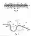 Fig. 02 - Endless abrasive belt and method of making the same
