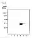 Fig. 05 - Novel gene relating to fibrotic conditions