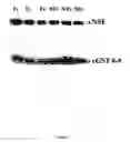 Fig. 06 - Gene expression and genetic changes implicated in alcoholism