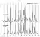 Fig. 02 - Pyridyl-substituted spiro-hydantoin crystalline forms and process