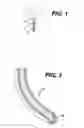 Fig. 02 - Systems and methods for removing plaque from a blood vessel