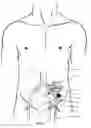 Fig. 04 - Blood pumping system and procedure