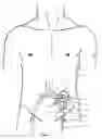 Fig. 05 - Blood pumping system and procedure