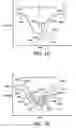 Fig. 02 - Sensor-equipped and algorithm controlled direct mechanical ventricular assist device