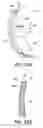 Fig. 49 - Sensor-equipped and algorithm controlled direct mechanical ventricular assist device