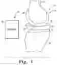 Fig. 02 - System and method for determining patient follow-up subsequent to an orthopaedic procedure