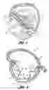 Fig. 02 - Apparatus for applying pressure to a head or neck and a method for relief