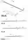 Fig. 05 - Multifilar cable catheter