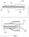 Fig. 08 - Method of surgical perforation via the delivery of energy