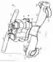 Fig. 03 - Adjustable spinal prosthesis
