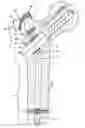 Fig. 01 - Device for bone fixation