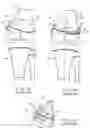 Fig. 02 - Orthopedic device and method for correcting angular bone deformity