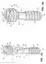 Fig. 02 - Compression bone screw