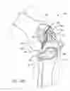 Fig. 07 - Instrumentation for knee resection