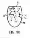 Fig. 06 - Preloaded IOL injector and method