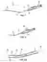 Fig. 02 - Articulating suturing device and method
