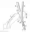 Fig. 28 - Articulating suturing device and method