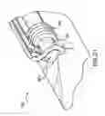 Fig. 35 - Articulating suturing device and method