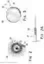Fig. 03 - Method and apparatus for augmentation of a sphincter