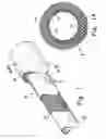 Fig. 02 - Anastomosis device and method