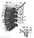 Fig. 09 - Expandable percutaneous sheath