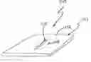 Fig. 01 - Device and method for closing an opening in a body cavity or lumen