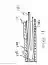 Fig. 06 - Device and method for closing an opening in a body cavity or lumen