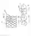 Fig. 09 - Device and method for closing an opening in a body cavity or lumen