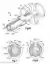 Fig. 08 - Apparatus and method for use in positioning an anchor