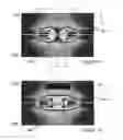 Fig. 06 - Methods and apparatus for intravascularly-induced neuromodulation